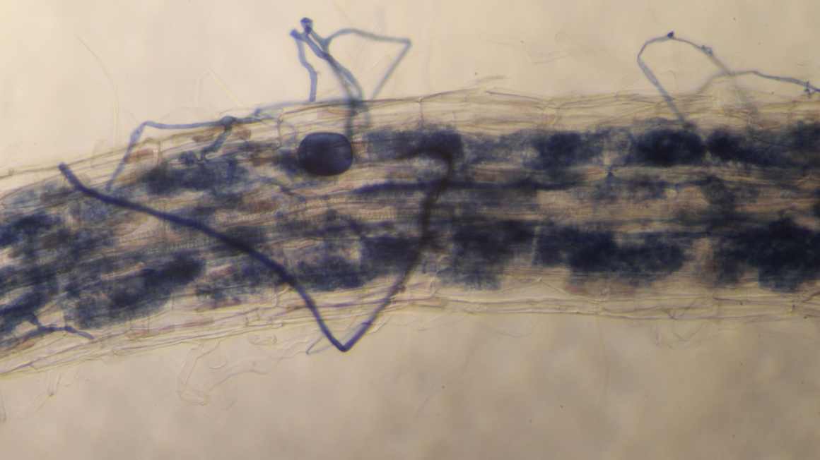 Mykorrhiza in Wurzel: Mit einer Färbung können Mykorrhizapilze in einer Wurzel sichtbar gemacht werden (Rhizophagus irregularis in Tomatenwurzel). 