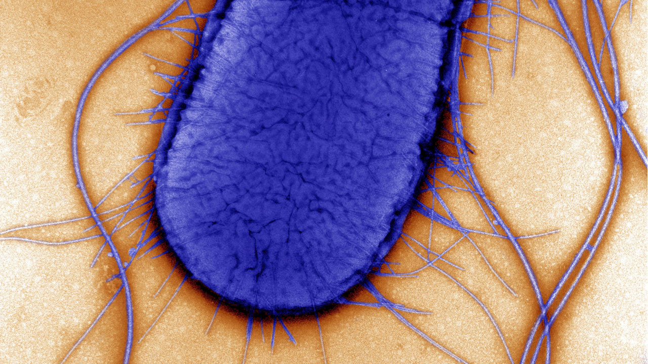 Mikroskopische Aufnahme des Bakteriums Escherichia coli