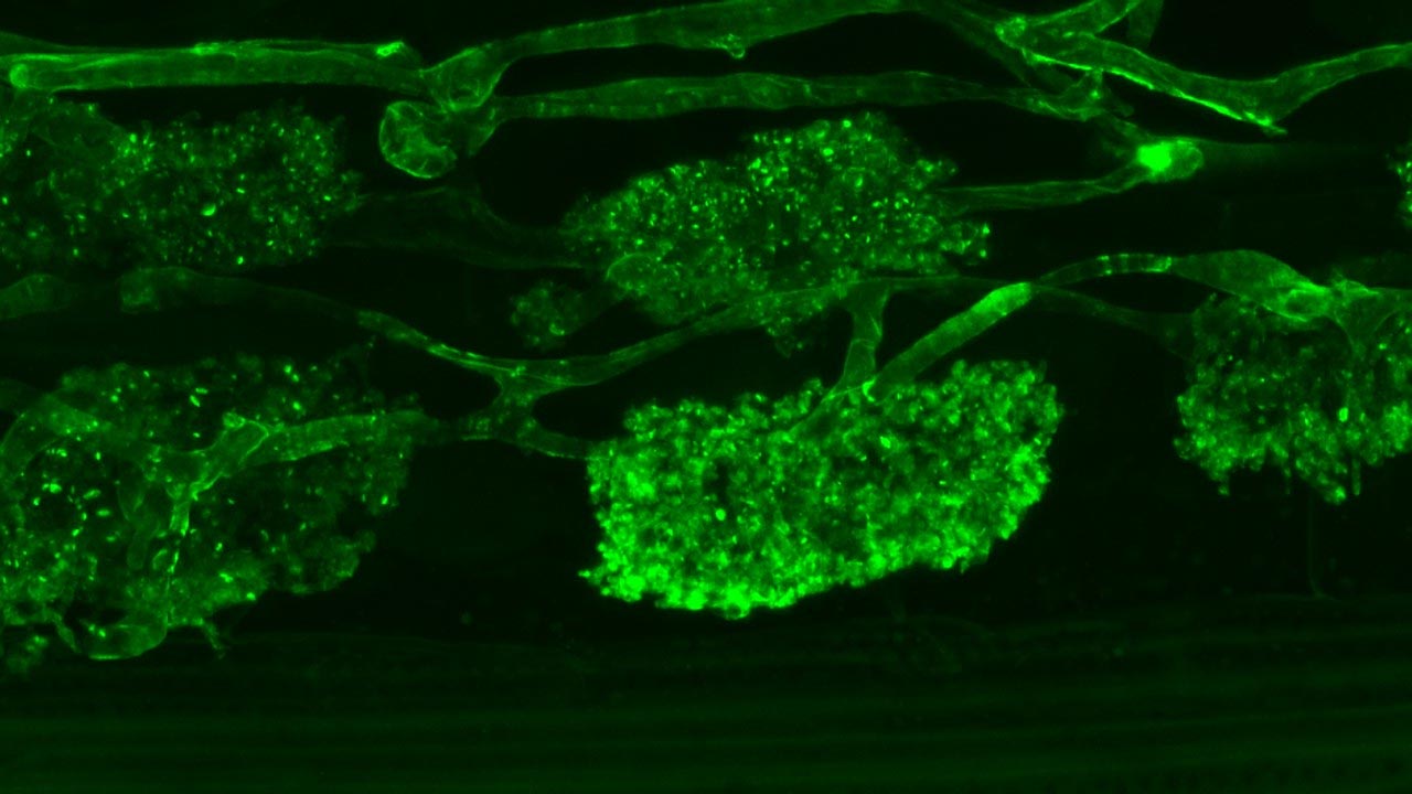 Ein Fluoreszenzfarbstoff macht die bäumchenförmigen Arbuskeln eines arbuskulären Mykorrhizapilzes in einer Wurzel gut sichtbar.