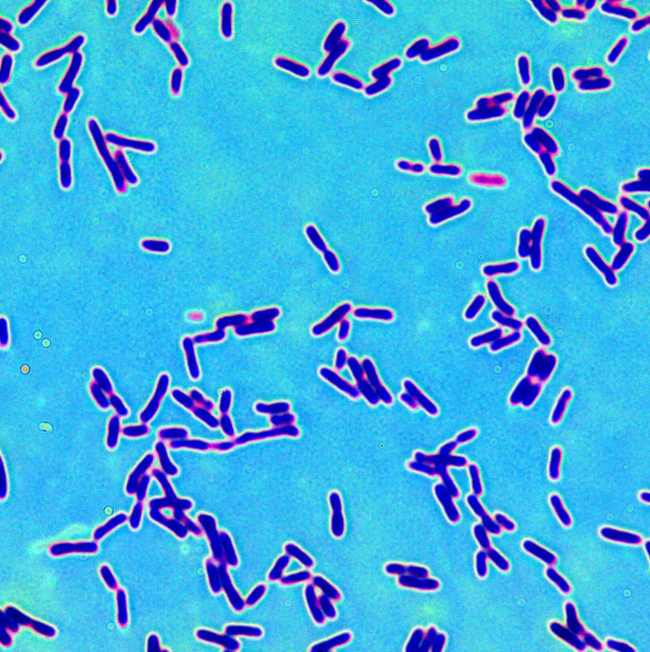 Milchsäurebakterien unterm Mikroskop