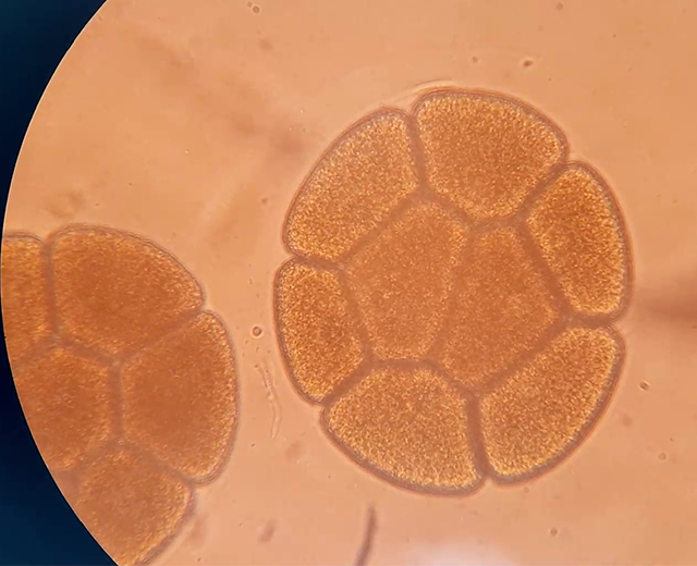 Eizellen Blasentang Mikroskop CRM