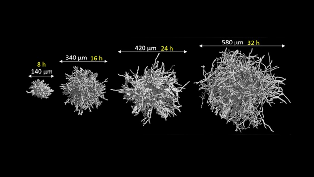 Dem Schimmelpilz Aspergillus beim Wachsen zugeschaut