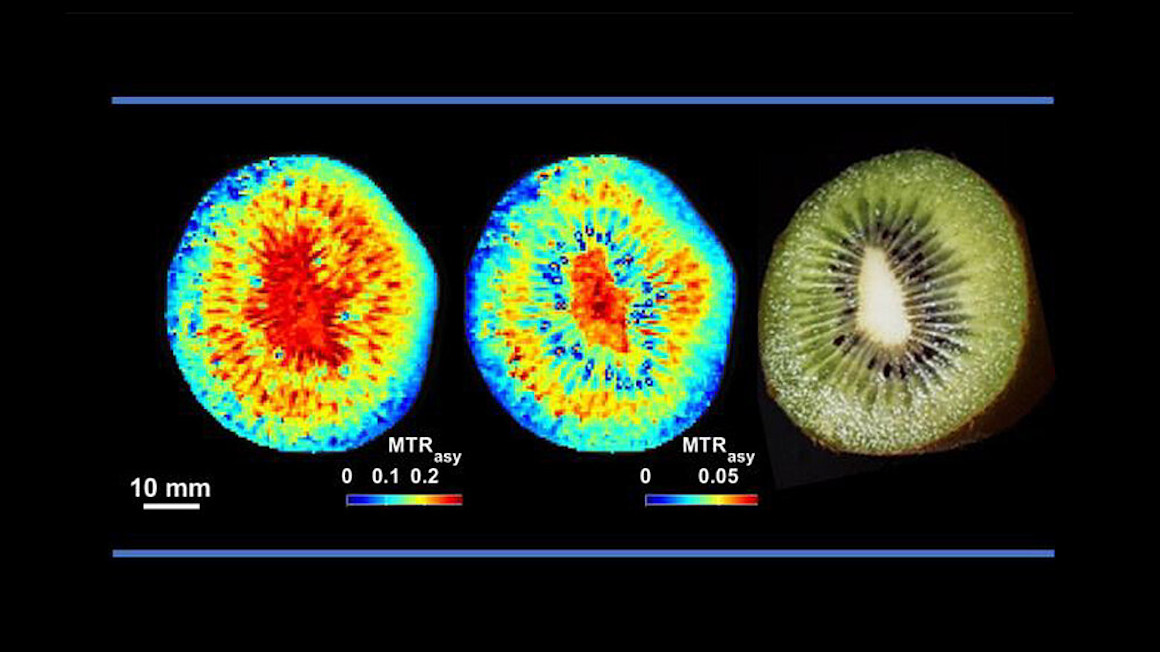 Mittels CEST (Chemical Exchange Saturation Transfer) wird die Verteilung von Zucker in Kiwifrucht (oben) und Zuckerrübe (unten) in-vivo sichtbar.