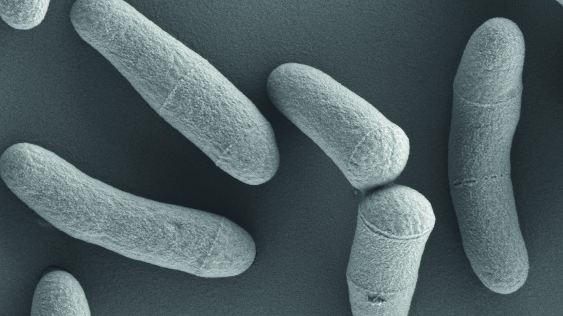 Corynebacterium glutamicum im Raster-Elektronenmikroskop. Die Stäbchen sind nicht ganz gleichmäßig und damit wie Keulen (griechisch coryne) geformt.