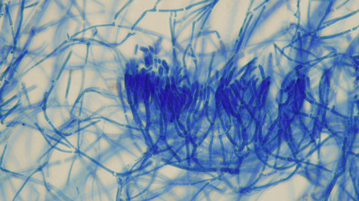 Lichtmikroskopische Aufnahme von blau eingefärbten Hyphen und Sporen des insektenpathogenen Pilzes Metarhizium lopezlastrae.