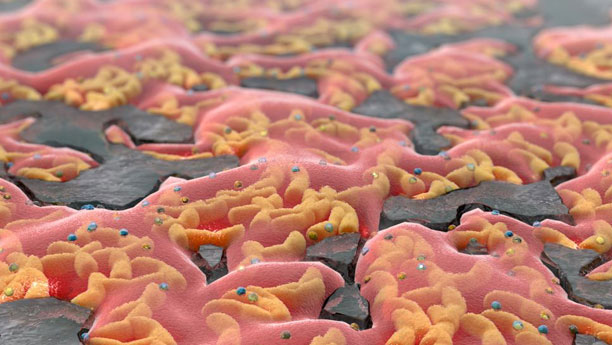 Bakterien und andere Mikroorganismen können durch ihre Stoffwechselprozesse Metalle aus Erzkörpern herauslösen