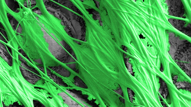 Rasterelektronenmikroskopische Aufnahme einer Haftscheibe (grün), die auf einem Blatt (grau) gesponnen wurde.