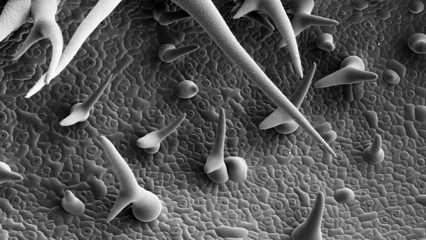 Per Rasterelektronenmikroskop ist zu sehen, wie sich Zellen auf der Blattoberfläche der Ackerschmalwand vermehrt haben. 