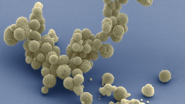 Bakterium mit künstlich geschaffenem Mini-Genom: Syn3.0 kann mit gerade einmal 473 Genen im Labor existieren.
