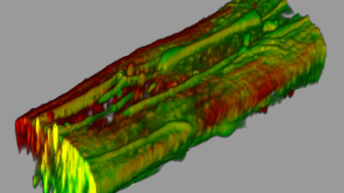 Konfokalmikroskopische Aufnahme einer nassgesponnenen Mikrofaser mit Shewanella oneidensis-Bakterien. Grün: lebendeBakterien, rot: tote Bakterien.