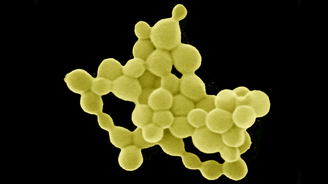 Diese Bakterien wandeln Gift zu Gold