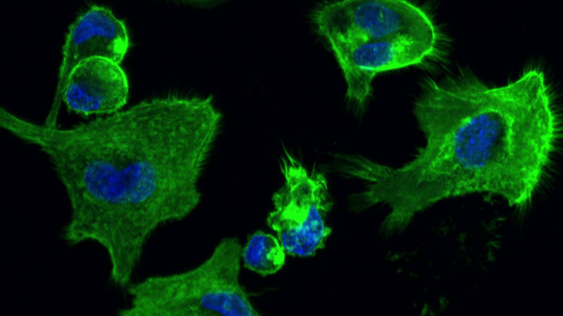 Diese Immunzellen exprimieren den betreffenden Rezeptor. Kern und Cytoskelett sind gefärbt.