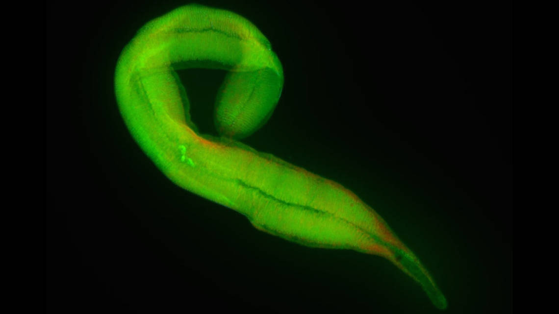 Das Bild zeigt ein Wimperntierchen mit grün eingefärbter DNA. Nur die drei hellen Punkte in der Mitte sind die Zellkerne des Wirtes. Alles übrige Grün geht zurück auf DNA des Bakteriums Kentron, das das Wimperntierchen besiedelt.