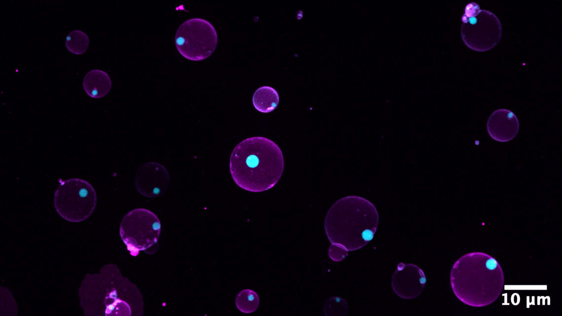 Künstliche Zellen mit Kompartimenten. Magenta kennzeichnet die Lipidmembran, Cyan die fluoreszenzmarkierten membranfreien Unterkompartimente.