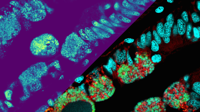 Die Metabolitenverteilungen als Heatmap (oberer linker Teil der Abbildung); Die untere rechte Seite des Bildes zeigt mikroskopische Details der Mikroben (in Rot und Grün) und der Muschelkerne.