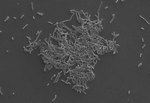 Elektronenmikroskopische Aufnahme von Prevotella copri, einem wichtigen Vertreter der Bacteroidetes Bakterien im menschlichen Darm.