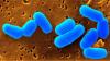 REM-Aufnahme von Corynebacterium glutamicum
