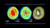 Mittels CEST (Chemical Exchange Saturation Transfer) wird die Verteilung von Zucker in Kiwifrucht (oben) und Zuckerrübe (unten) in-vivo sichtbar.