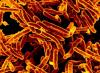 Die Tuberkulose-Erreger sind kleine stäbchenförmige Bakterien. rotwild, rothirsch, tuberkulose-erreger