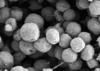 Die elektronenmikroskopische Aufnahme zeigt ein methanogenes Archaeon.